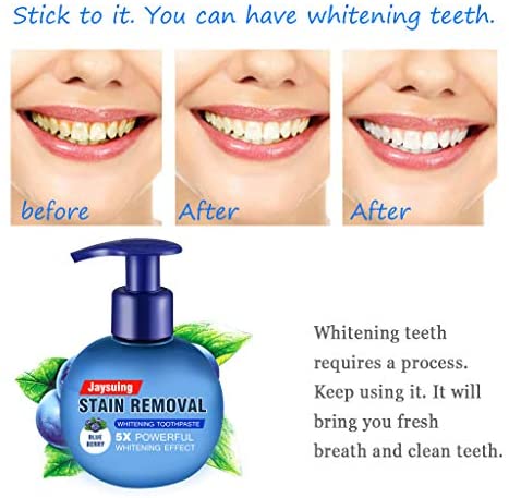 Stain Removal Whitening Toothpaste, ALLCOME Baking Soda Strong Cleaning Power Natural Stain Remover Toothpaste (Blue) Stain Removal Whitening Toothpaste, ALLCOME Baking Soda Strong Cleaning Power Natural Stain Remover Toothpaste (Blue)